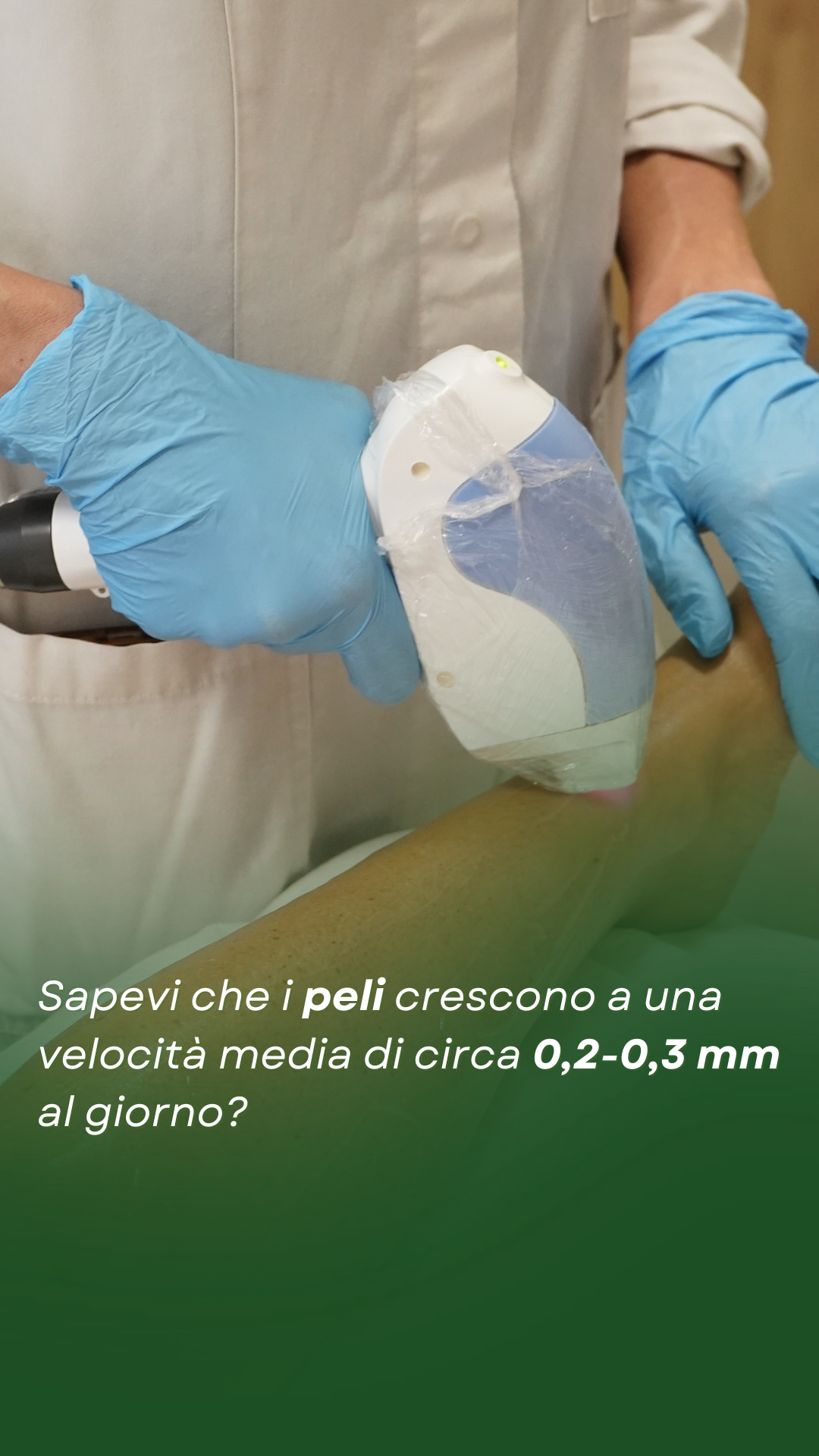 Reel (2)